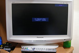 画像ギャラリー No.008のサムネイル画像 / 【西川善司】腫瘍摘出手術を受けて自らがバイオハザード風になった話