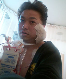 画像ギャラリー No.014のサムネイル画像 / 【西川善司】腫瘍摘出手術を受けて自らがバイオハザード風になった話