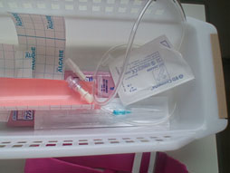 画像ギャラリー No.015のサムネイル画像 / 【西川善司】腫瘍摘出手術を受けて自らがバイオハザード風になった話