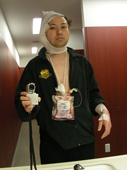 画像ギャラリー No.016のサムネイル画像 / 【西川善司】腫瘍摘出手術を受けて自らがバイオハザード風になった話