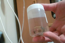 画像ギャラリー No.019のサムネイル画像 / 【西川善司】腫瘍摘出手術を受けて自らがバイオハザード風になった話