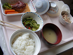 画像ギャラリー No.020のサムネイル画像 / 【西川善司】腫瘍摘出手術を受けて自らがバイオハザード風になった話