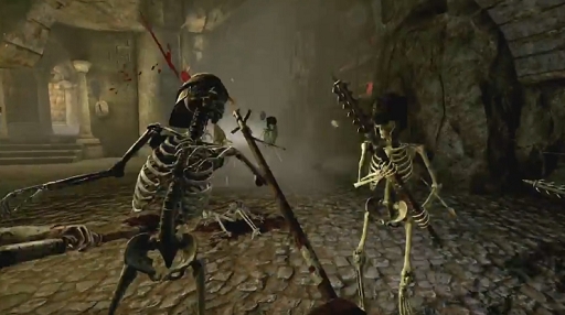 Chivalry: Medieval Warfare Launch Trailer